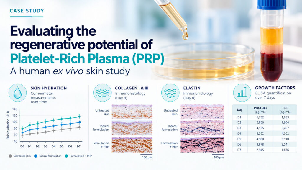 Regenerative potential platlet rich plasma